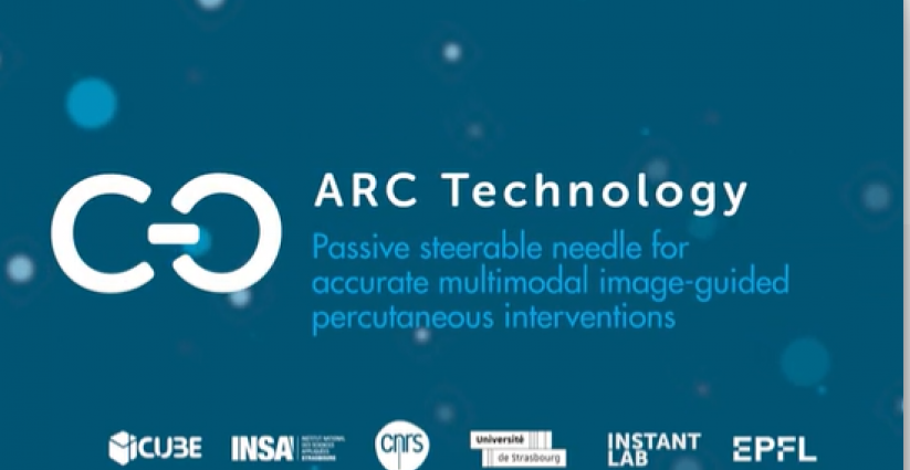 Video_ARC needle